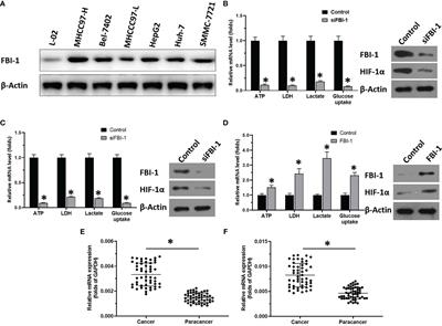 Knockdown of FBI-1 Inhibits the Warburg Effect and Enhances the Sensitivity of Hepatocellular Carcinoma Cells to Molecular Targeted Agents via miR-3692/HIF-1α